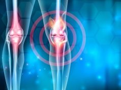 ASTRO: Low-Dose Radiation Improves Clinical Outcomes in Mild-to-Moderate Knee Osteoarthritis