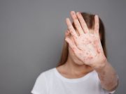 Hundreds of Kids Forced Into Quarantine as Measles Outbreaks Spread