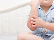 Child’s Atopic Dermatitis Linked to Maternal Depression Scores