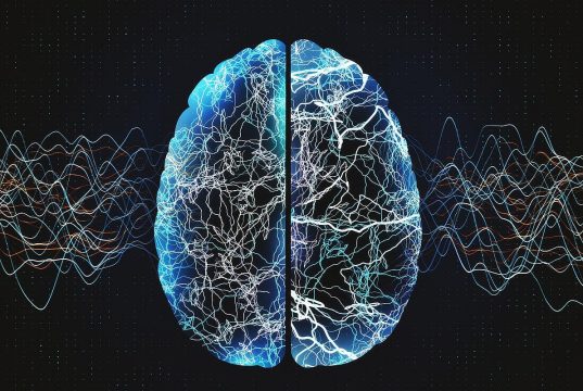 AI-Driven Method IDs Alzheimer Disease and Related Dementias in Primary Care
