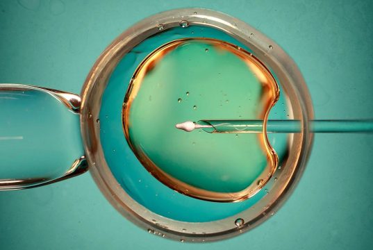 Fertility Treatment at Older Ages Unlikely to Succeed With Patients’ Eggs