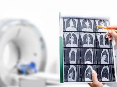 Direct-to-Patient Digital Health Program Improves Lung Cancer Screening Rates