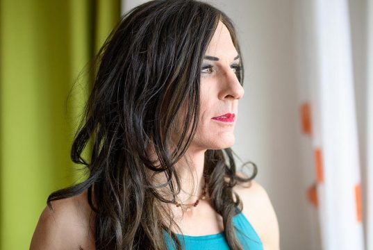 CV Risk Not Increased With Gender-Affirming Hormone Therapy Use in Transgender Women