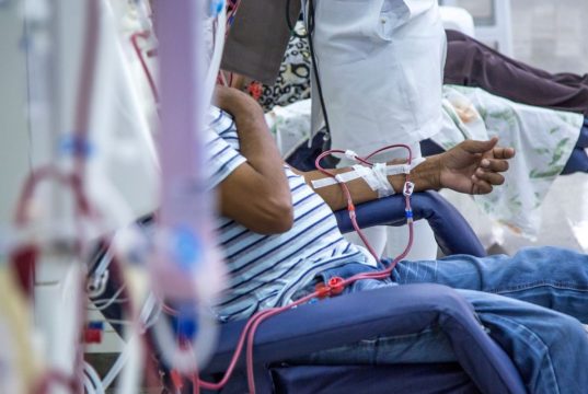 Conservative Dialysis Strategy May Be Beneficial in Acute Kidney Injury