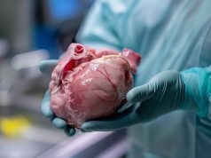 Could Pig Kidneys End the Transplant Shortage? First U.S. Trial Begins