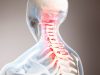 Long-Term Morbidity, Mortality Increased After Traumatic Spinal Cord Injury