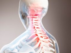 Long-Term Morbidity, Mortality Increased After Traumatic Spinal Cord Injury