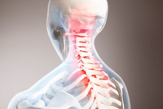 Long-Term Morbidity, Mortality Increased After Traumatic Spinal Cord Injury